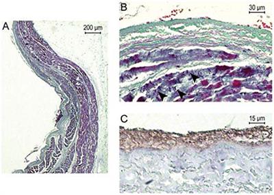 The effect of ionizing radiation through cardiac stereotactic body radiation therapy on myocardial tissue for refractory ventricular arrhythmias: A review